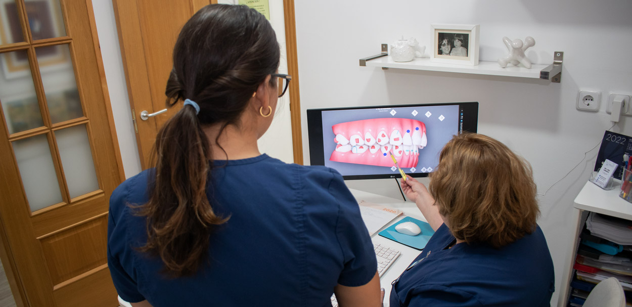 Tratamientos de odontología general - Carrasco Clínica Dental Barcelona